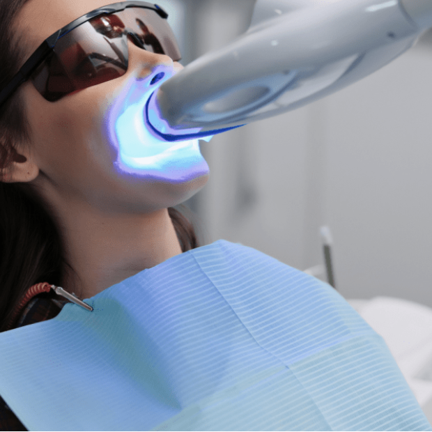 Blanqueamiento Dental