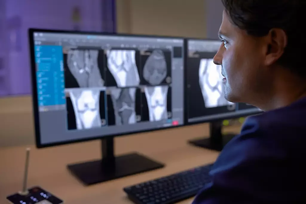 Medical professional analyzing X-ray or MRI scans on dual computer monitors.