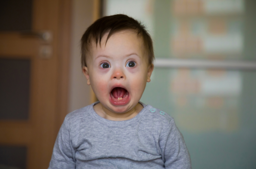 Toddler with Down syndrome using his voice