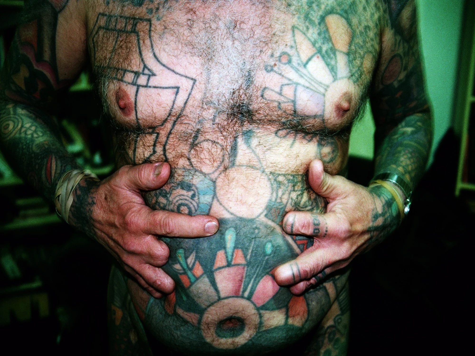 Nikki Johnson (American, b. 1972), David Amputation Fetishist, 2007, Digital print (from a set of images), Courtesy the artist