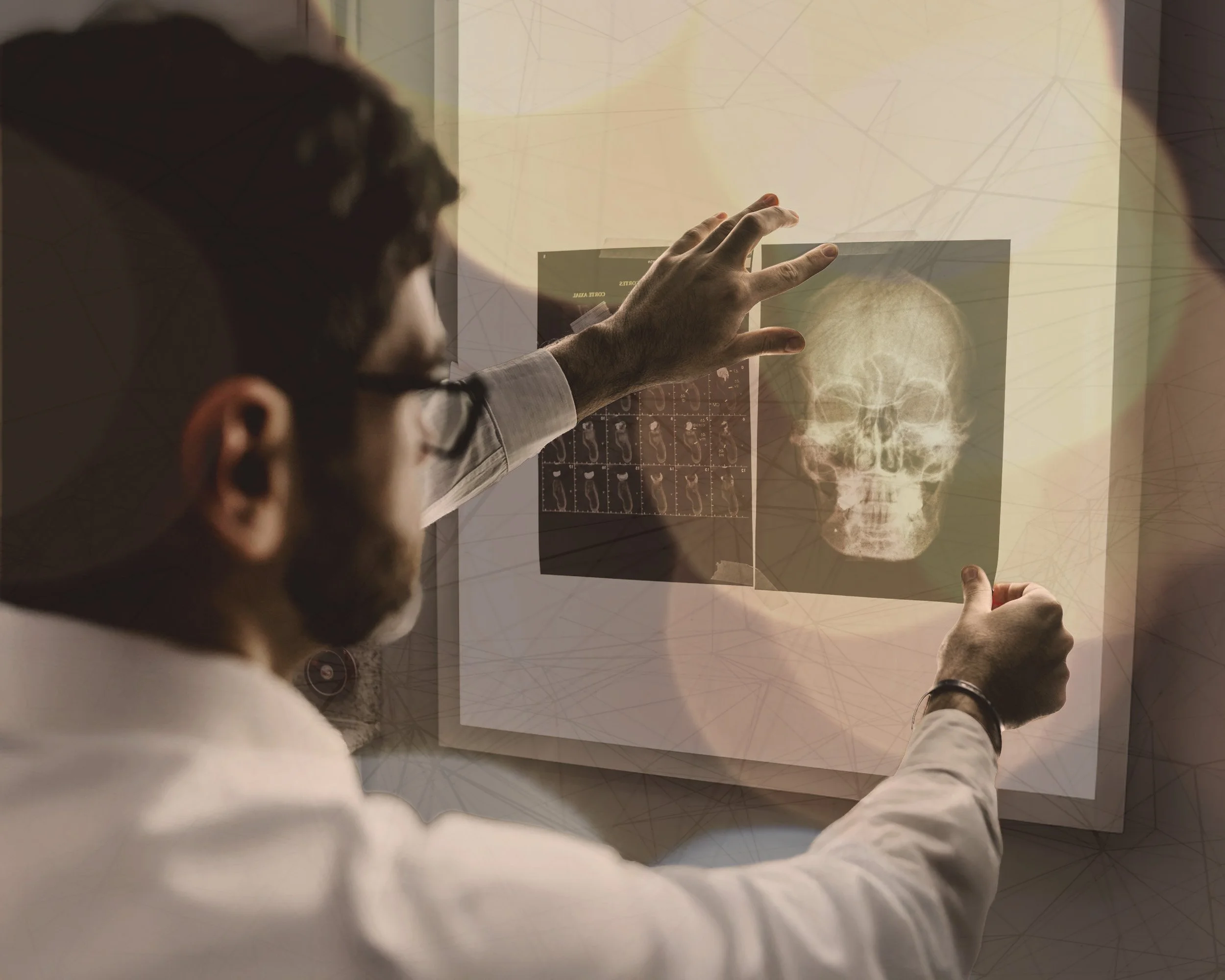 A person with glasses and a beard examines an X-ray of a skull on a lightbox in a medical setting.