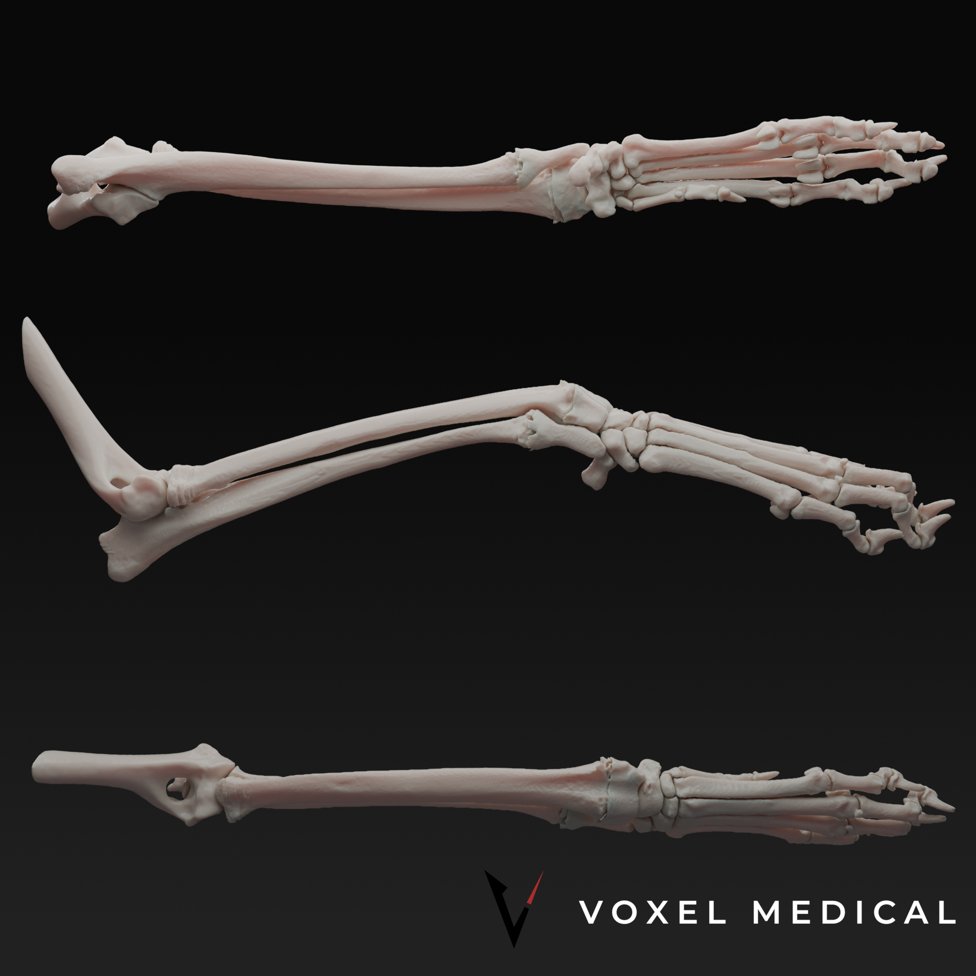 Canine Radius Malformation