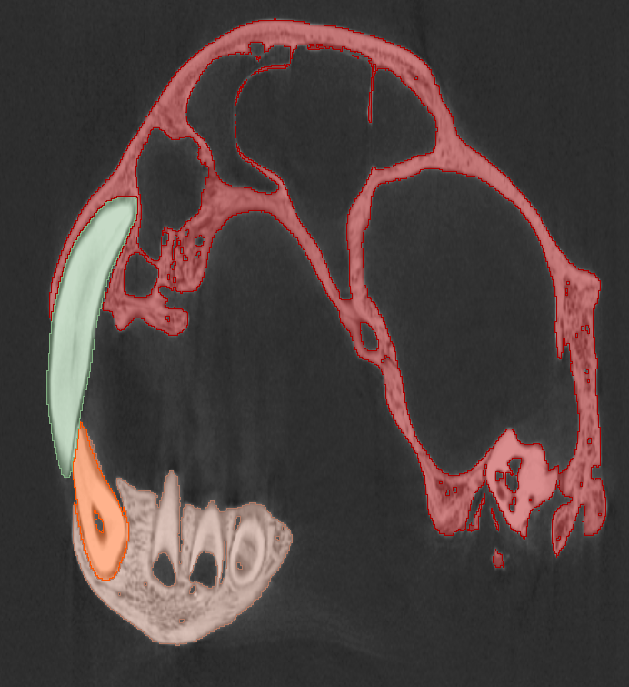 CT.png
