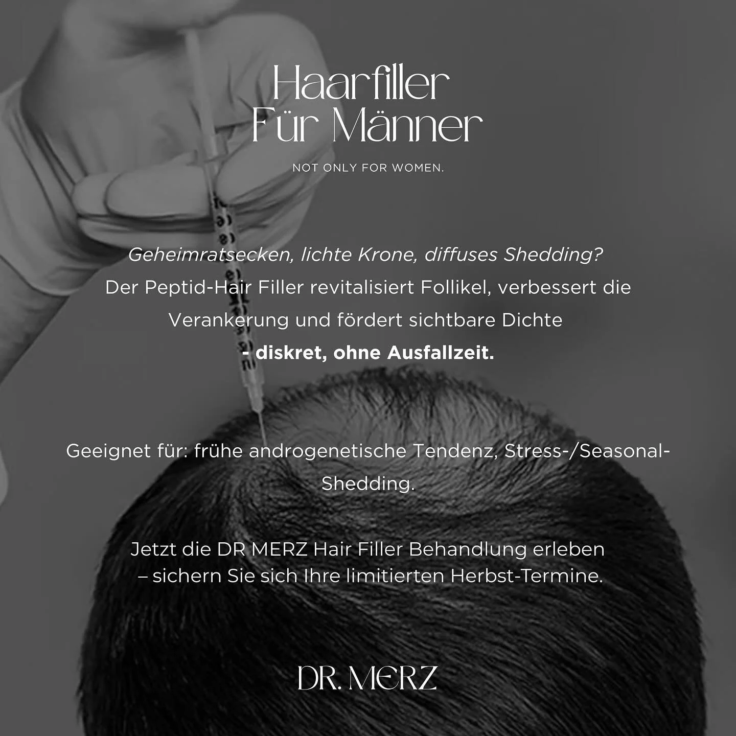 – Hair Filler für Männer by DR MERZ –
Der Hair Filler by DR MERZ unterstützt die Kopfhaut mit medizinisch entwickelten Peptiden und sorgt für sichtbar gepflegteres, vitaleres Haarbild – besonders in Phasen von S