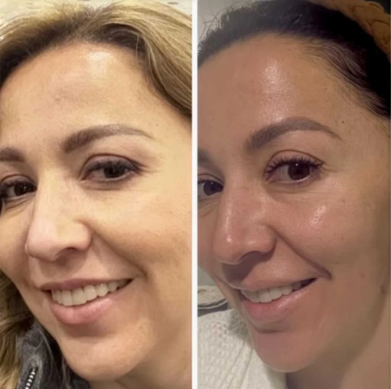 beforeAfter.jpg