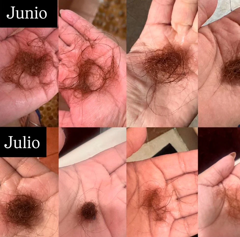 Testimonio_Pelo.jpg
