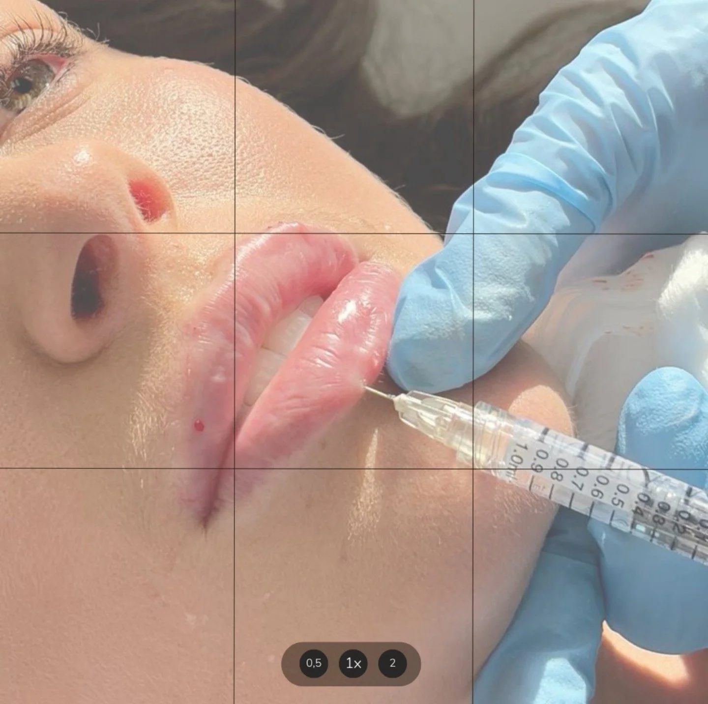 Your Comfort + Safety = Our Priority🤍 
We know aesthetic treatments can feel a little daunting that’s why we go the extra mile to make sure you feel safe, informed, and comfortable every step of the way.
From numbing cream and cold spray to