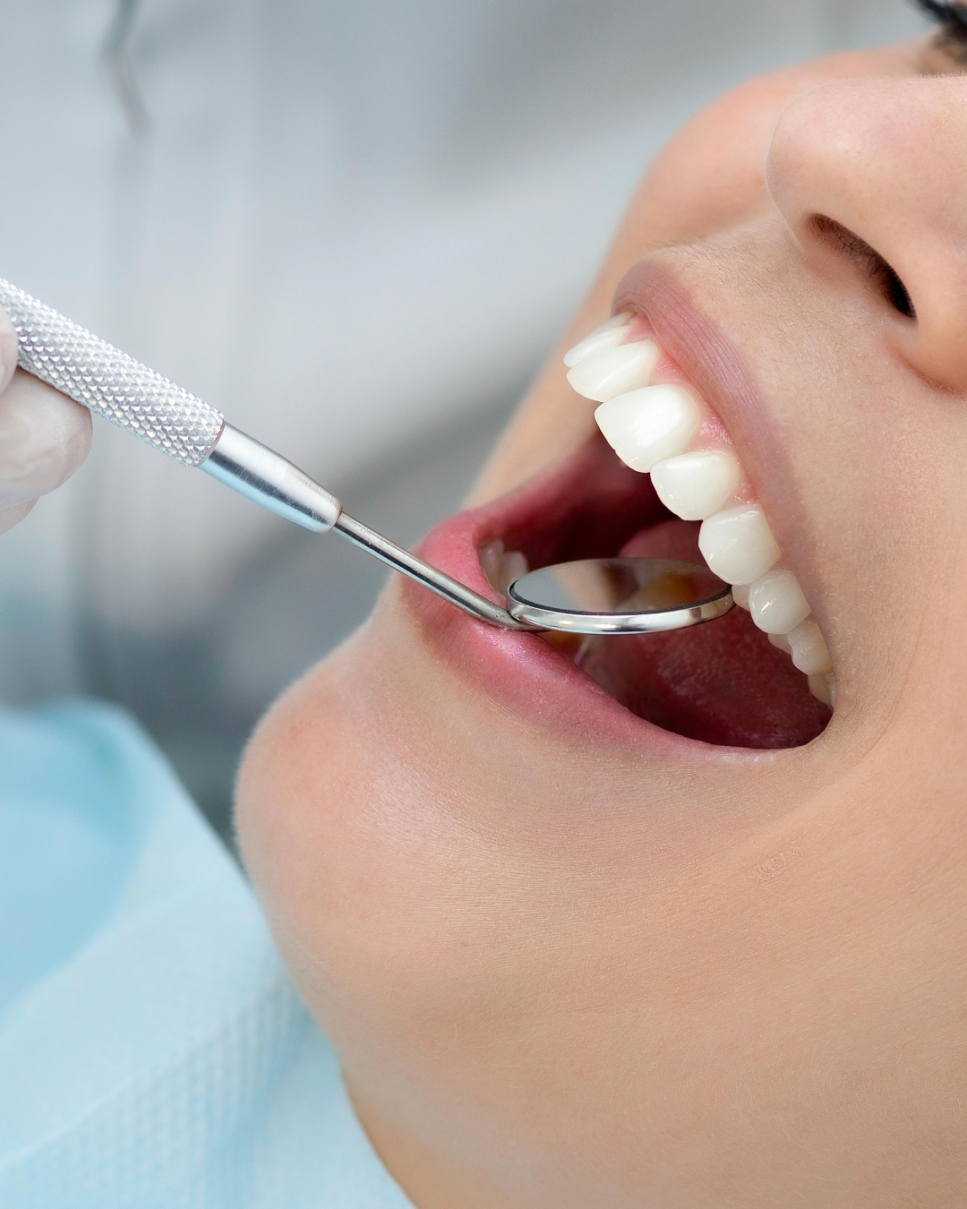 Comfort-Focused Adult Dental Cleaning