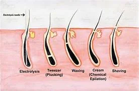 Should I pluck unwanted facial hair?   How can I get rid of those hair permanently?