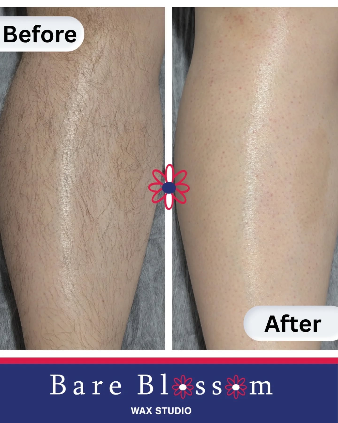 Winter is actually the BEST time to wax.
Consistent waxing through the colder months helps your hair grow back finer, softer, and slower....so by summer, you&rsquo;re already ahead 💙

📆Booking info in Bio

📍 Find me at 941 Lehman Ave, Suite 104, B