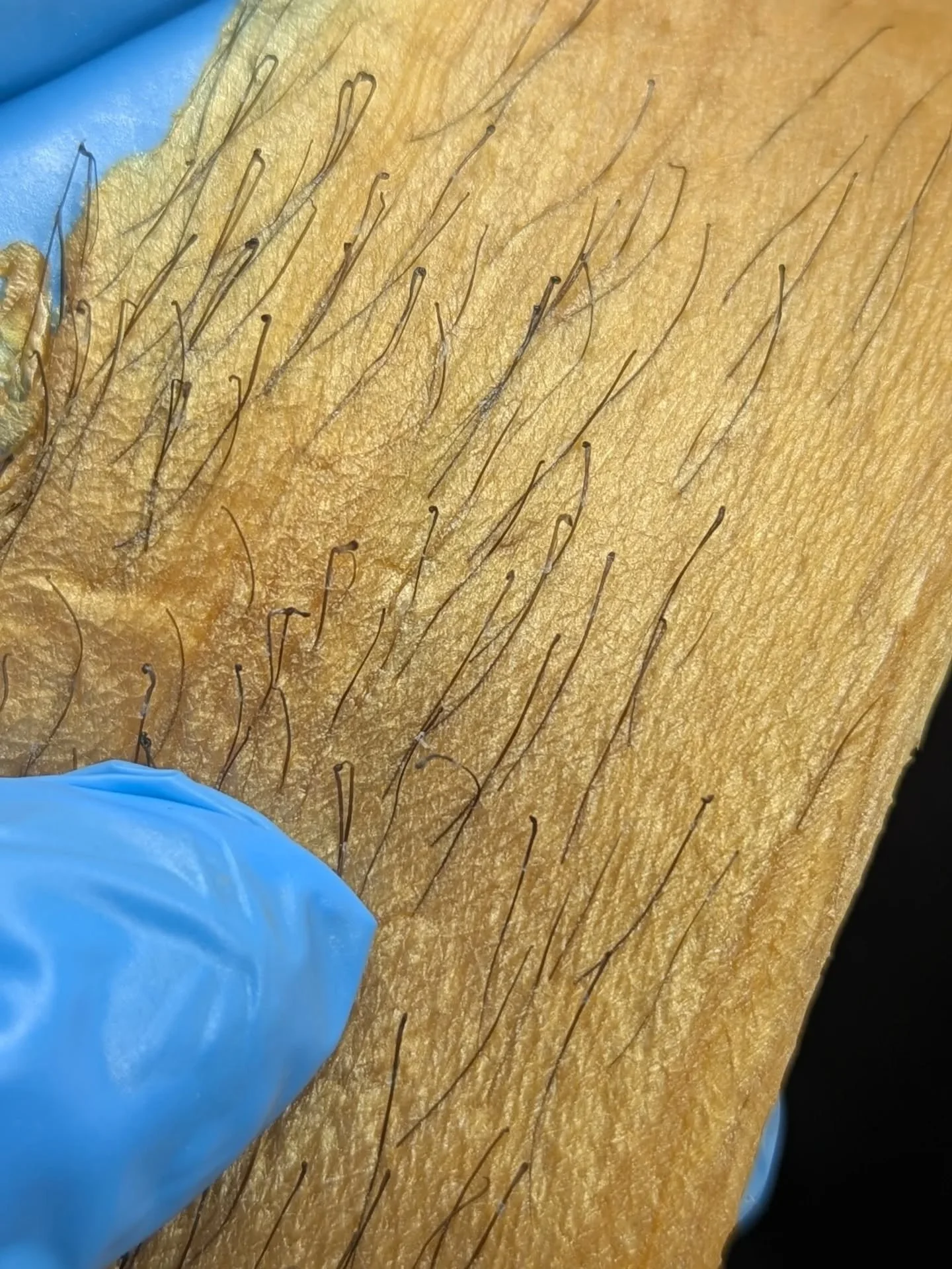 Pulling the hair from the root is what makes waxing a game changer!! 
When we remove the entire hair (not just cut it like shaving), you get:
✨ Slower regrowth
✨ Softer, finer hair over time
✨ Smoother skin with no blunt stubble
✨ Results that last  