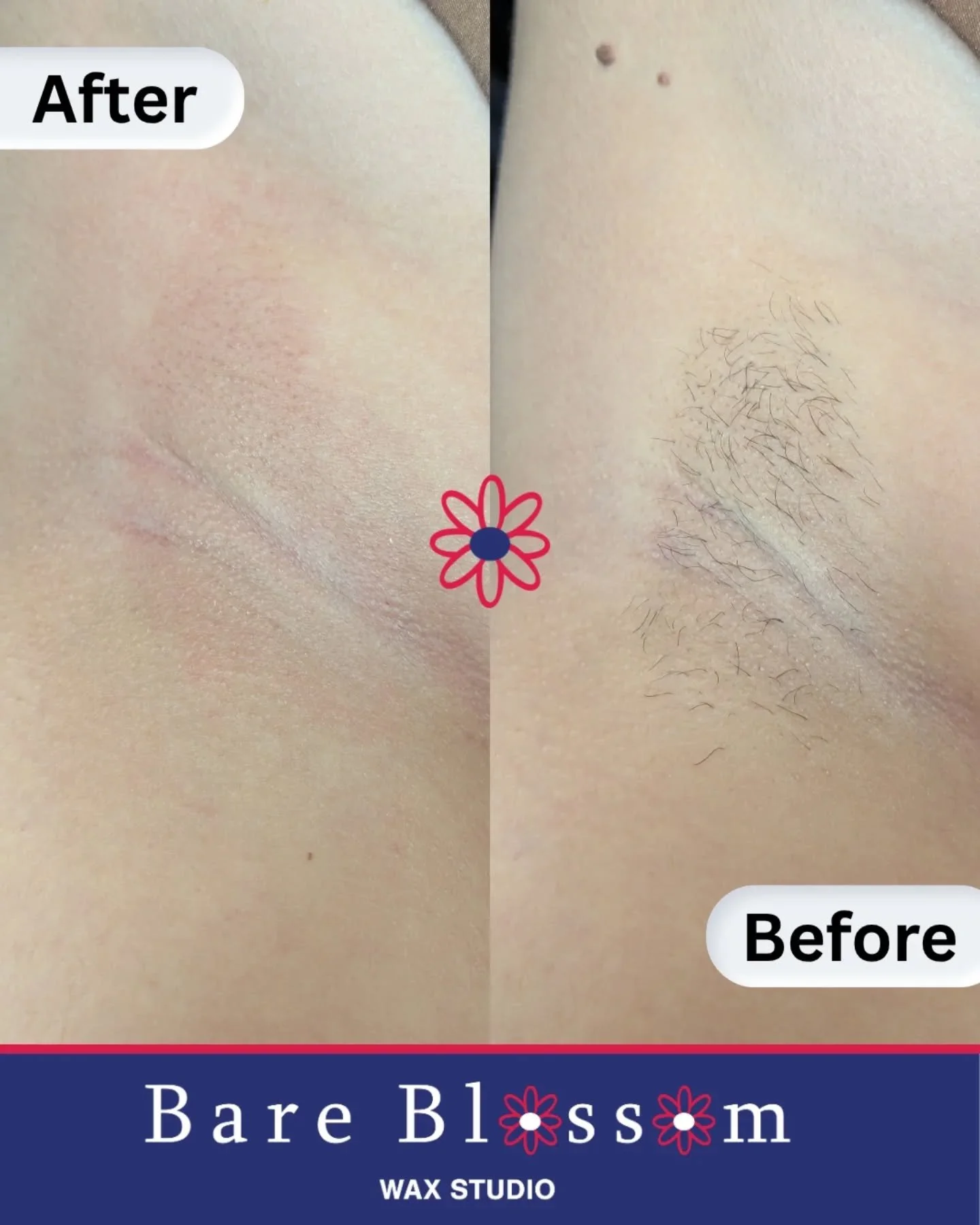 Tired of shaving every other day? 
Waxing keeps your underarms smoother, longer &amp;  with less irritation over time 💙

📆Booking info in Bio

📍 Find me at 941 Lehman Ave, Suite 104, Bowling Green, KY 
{{located inside Ascent Therapeutics Bodywork