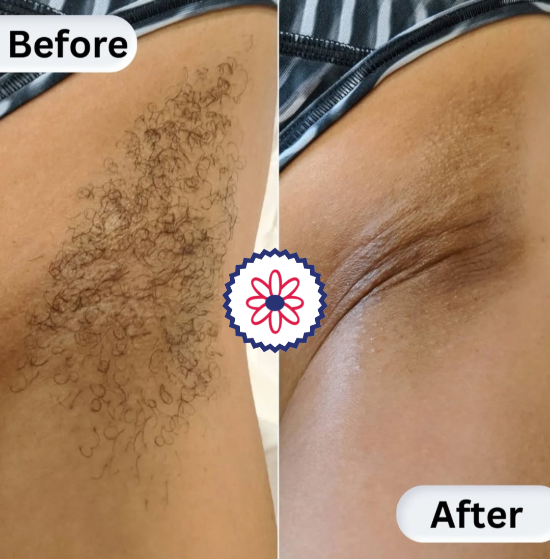 Arm pit waxing service before and after