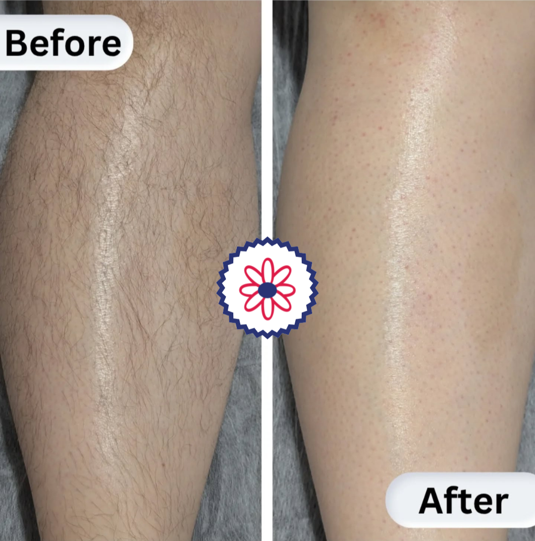 Before and after leg waxing results showing smooth, hair-free skin with long-lasting results.
