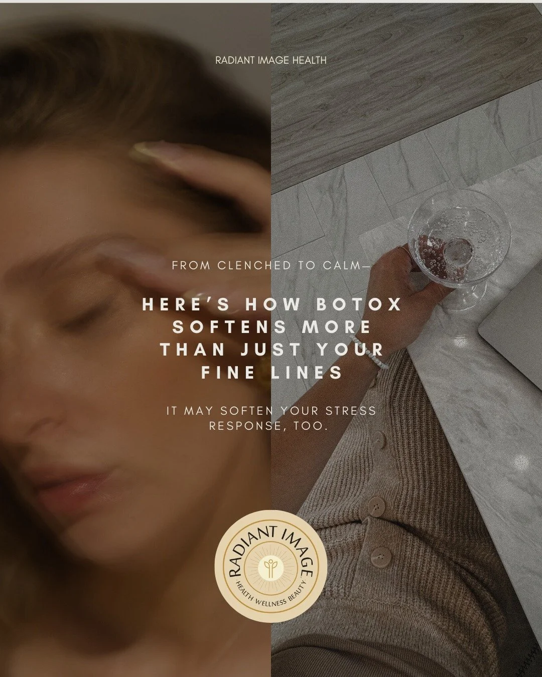 Most people think of expression lines as something that happens to the face over time.

What we see clinically is different. They often reflect how long the nervous system has been carrying tension without a pause.

When stress becomes chronic, t