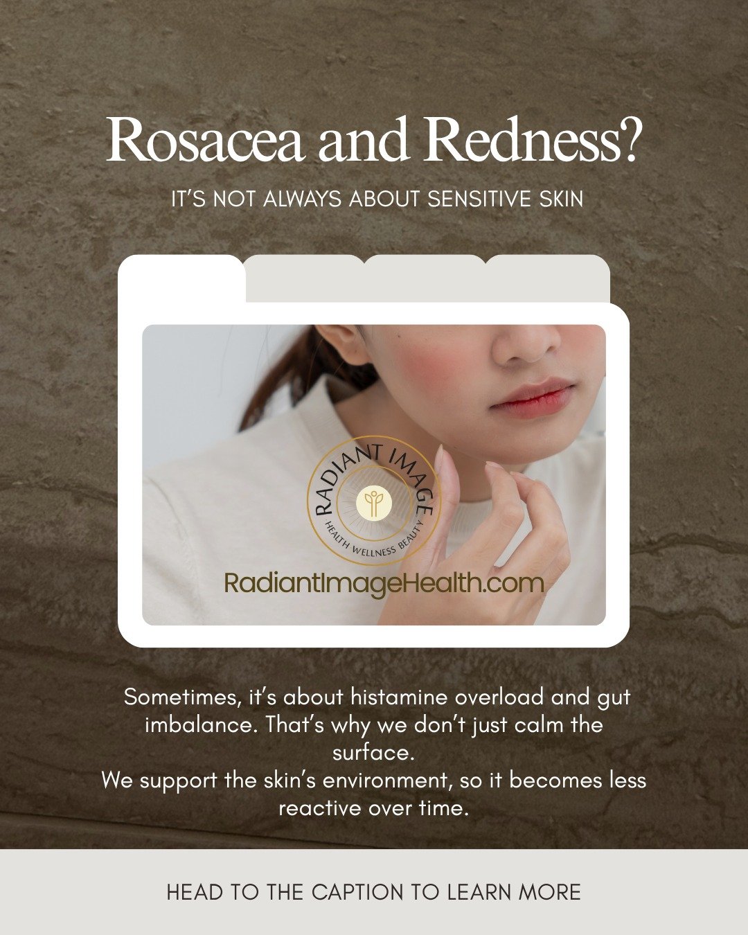 If your skin flushes easily, feels reactive, or flares with stress or certain foods, your issue might not be topical.
It might be internal inflammation.

Here&rsquo;s what we see in practice:

&rarr; When the gut is imbalanced, it affects skin b