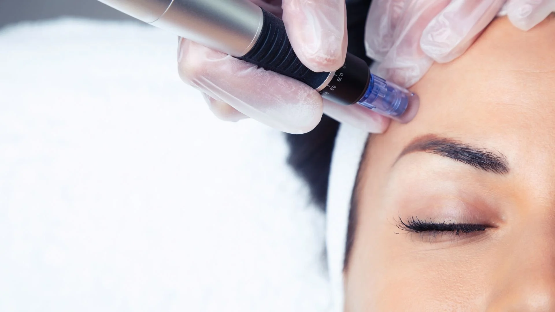A person receives a cosmetic treatment on their forehead using a handheld device while lying down with closed eyes.