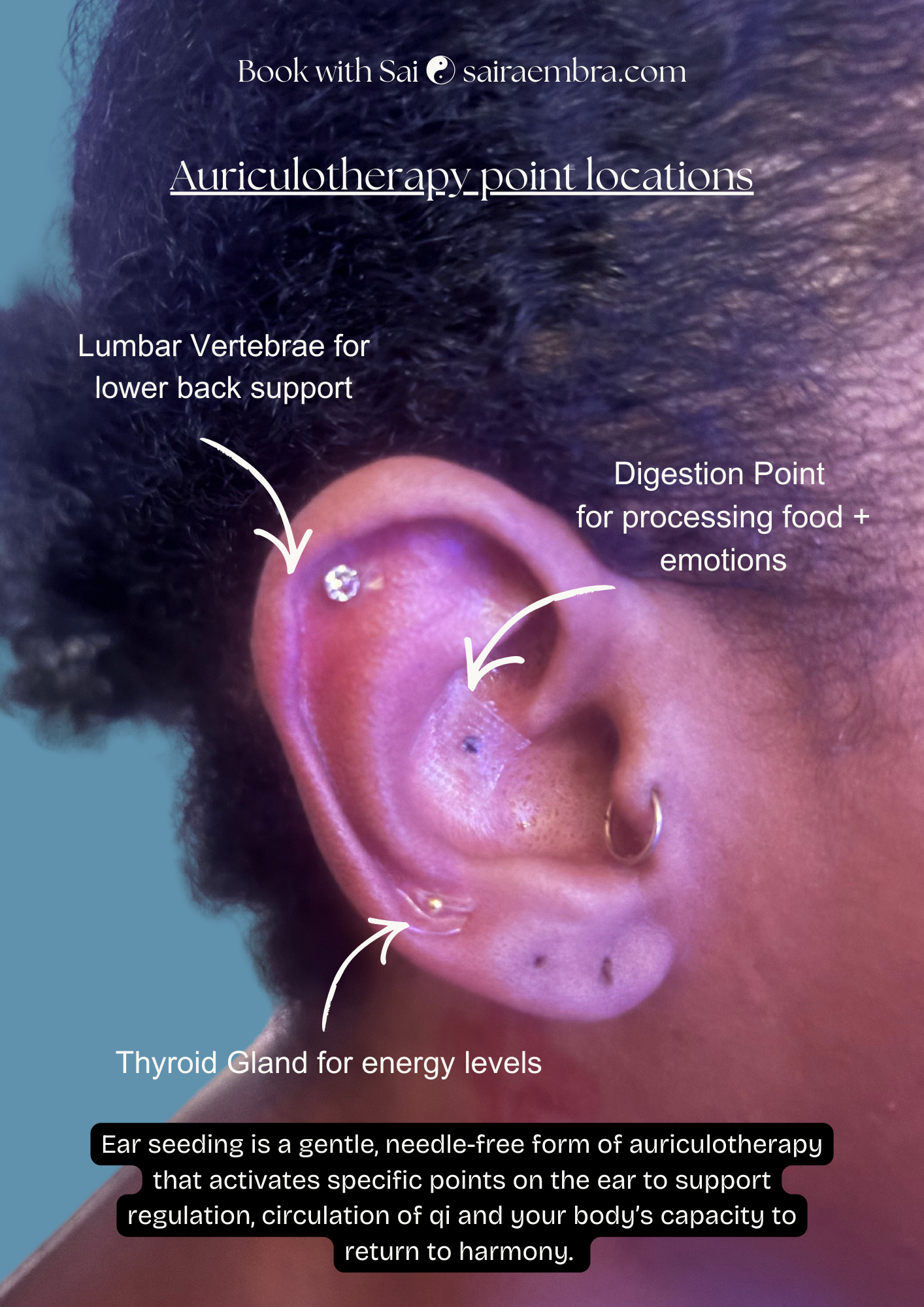 insomnia help acupuncture.png