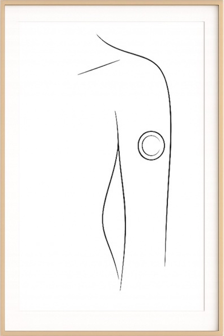 Continuous Glucose Monitoring (CGM) | Thyroid dysfunction and blood sugar dysregulation are deeply intertwined. Hypothyroidism slows glucose clearance and blunts insulin sensitivity. Hyperthyroidism drives instability in the opposite direction. CGM  