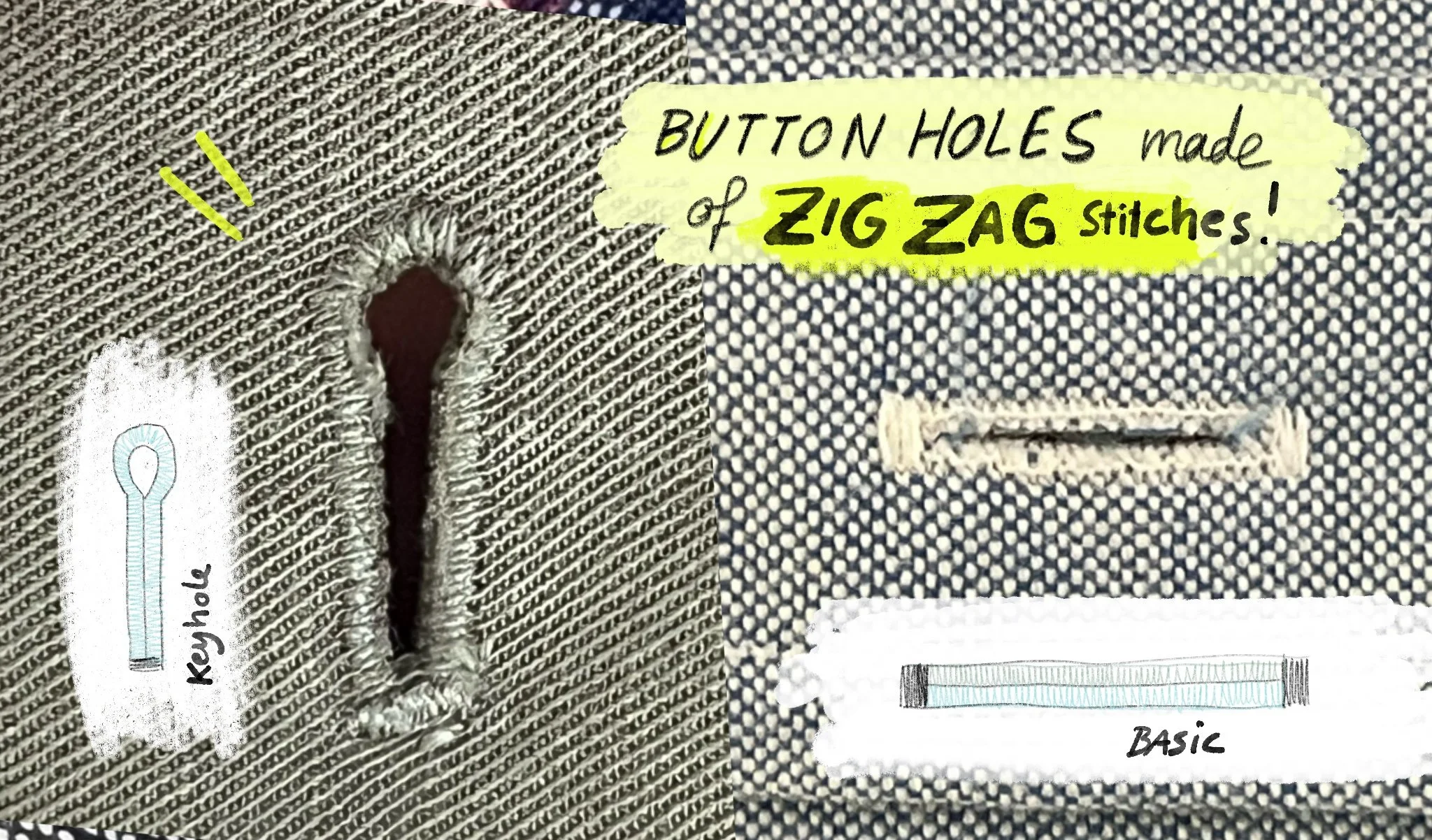 button hole infographic