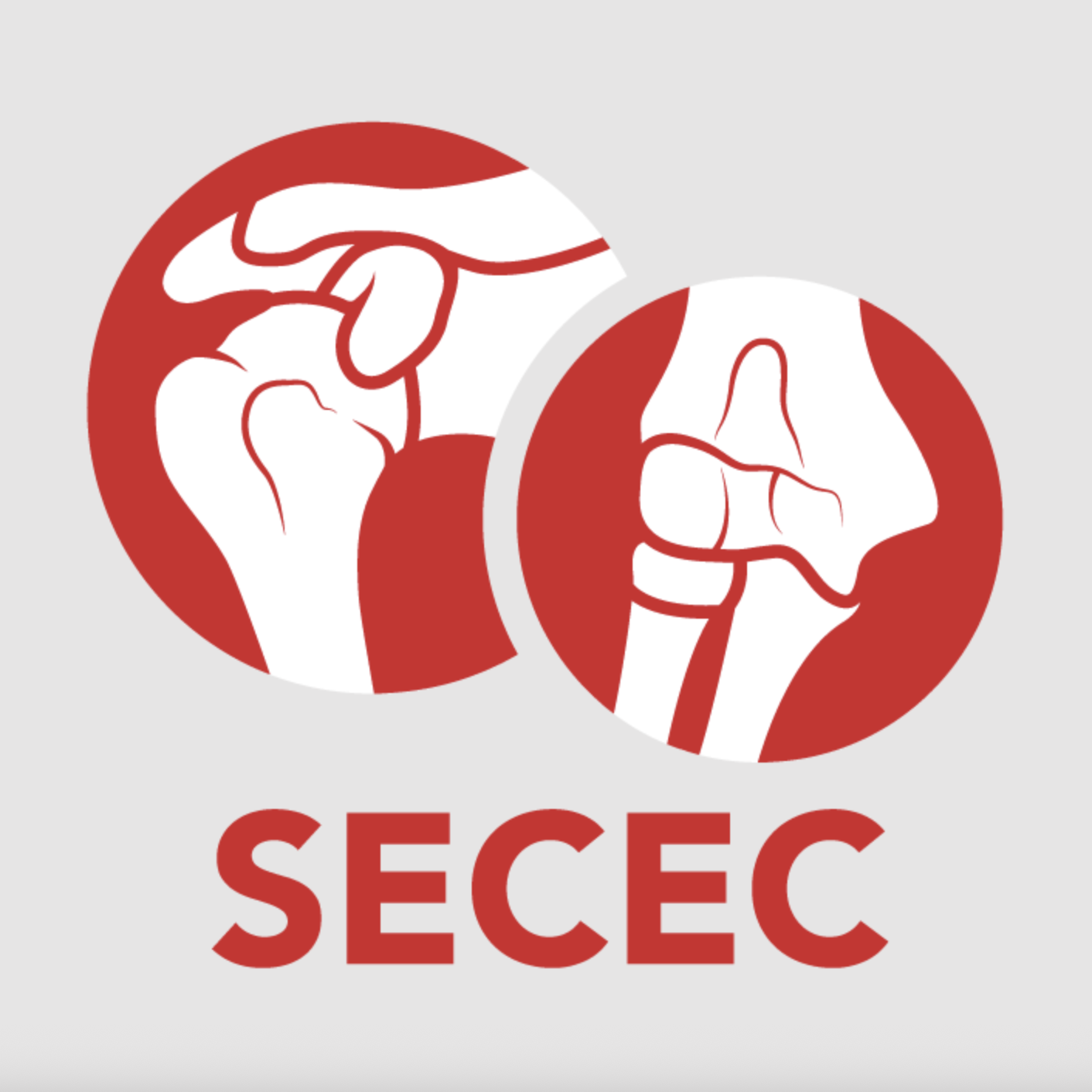 Illustration of septic shock diagnosis in two circular diagrams with the acronym SECEC below.
