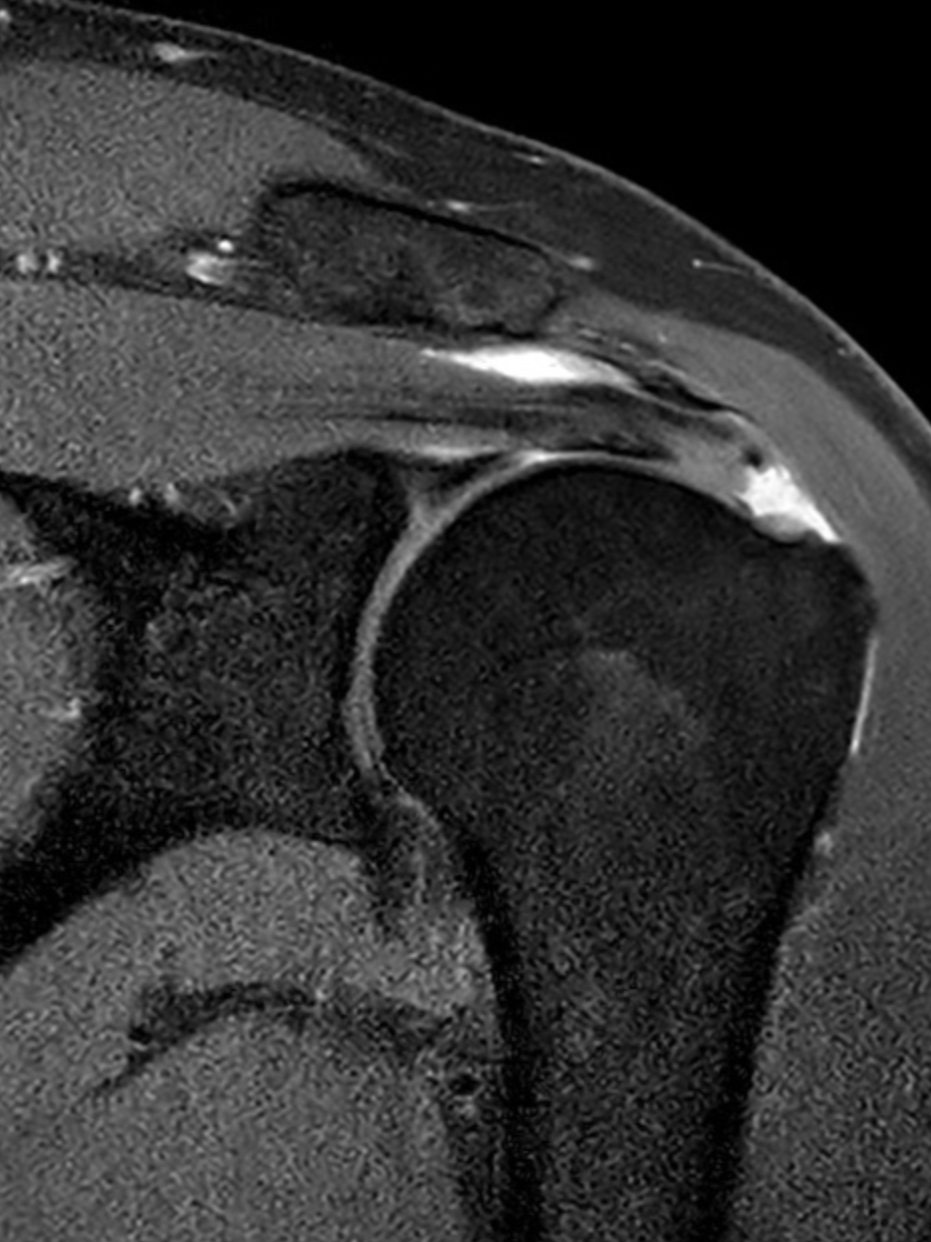 Close-up of a glass of dark liquid with a straw, resting on a textured surface.