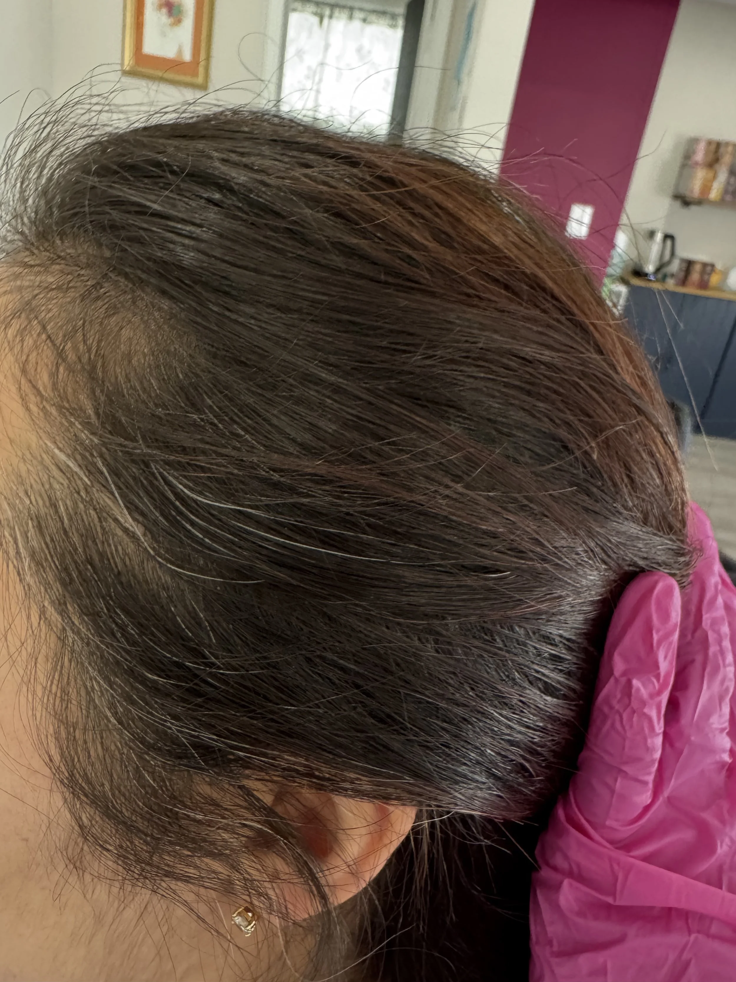 Before: (Same Person, Different Angle)