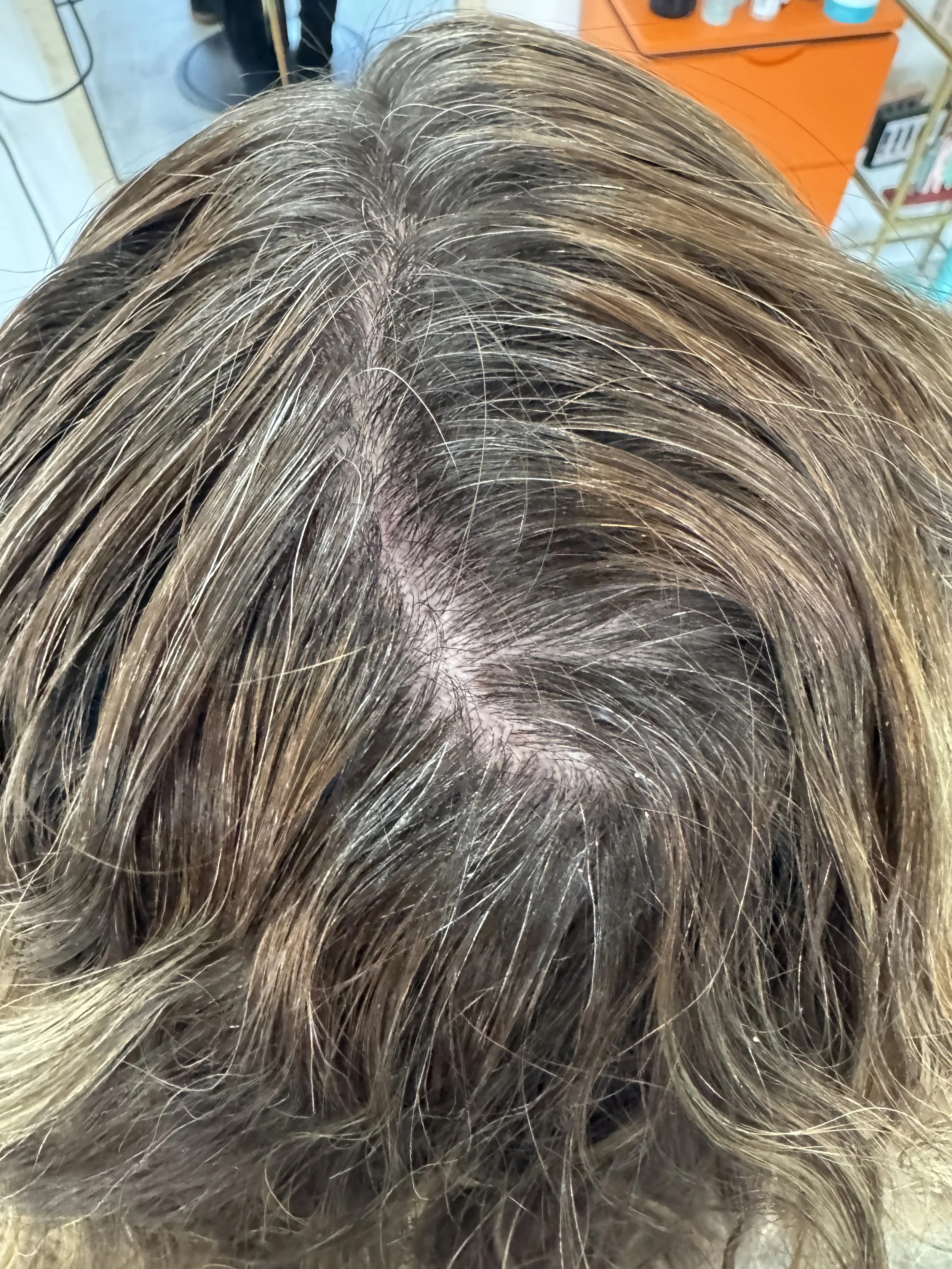 Before: Plant Root Renewal