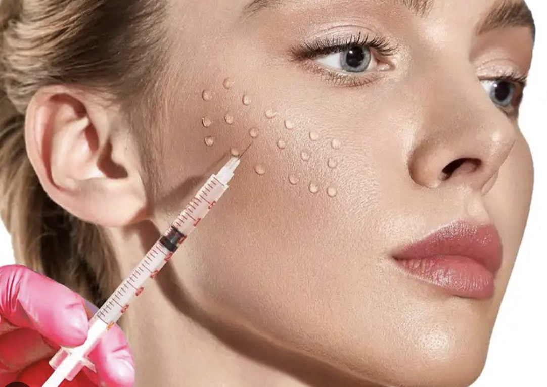 Restylane Skin Boosters