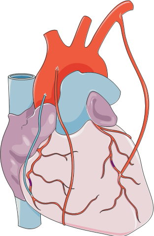 N2 - M 1 - PATHOLOGIES CARDIOVASCULAIRES