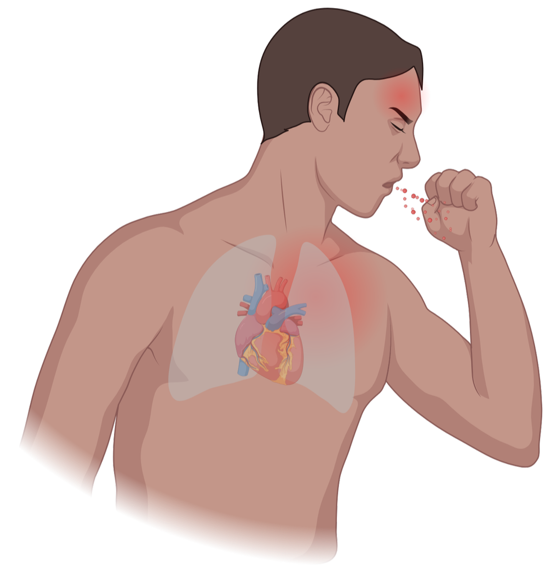 Un homme génère une toux, illustrant un malaise cardiaque avec une zone de douleur en haut de la poitrine et une inflammation.