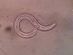 Parasite Cleanse