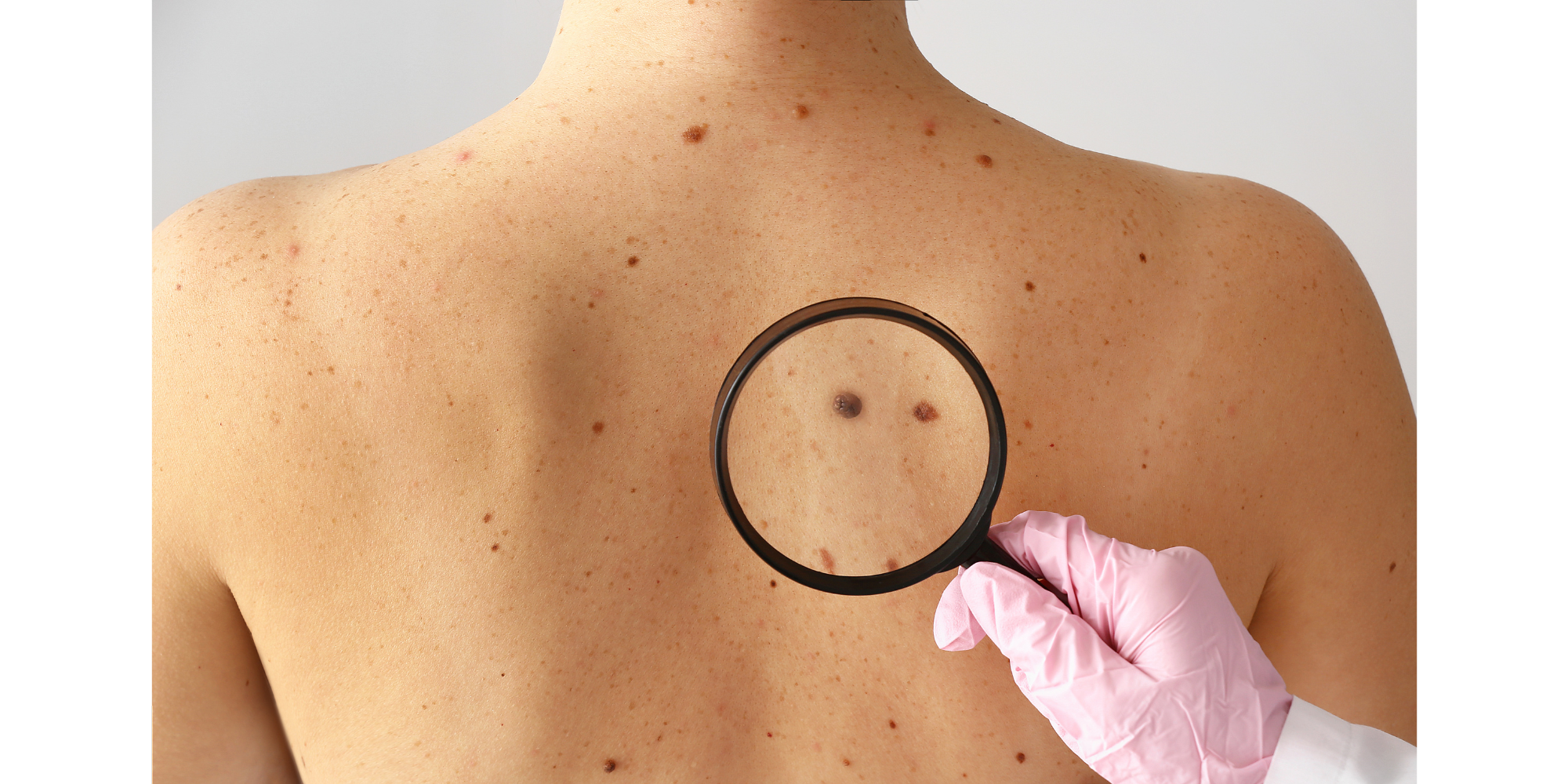 Moles: Don’t Go In Blind