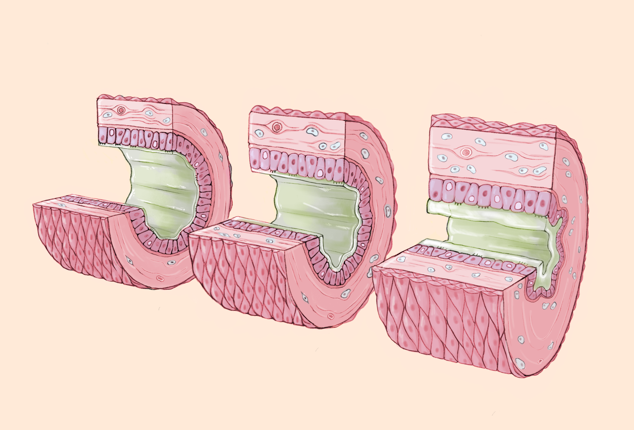 patho_cubes_web.png