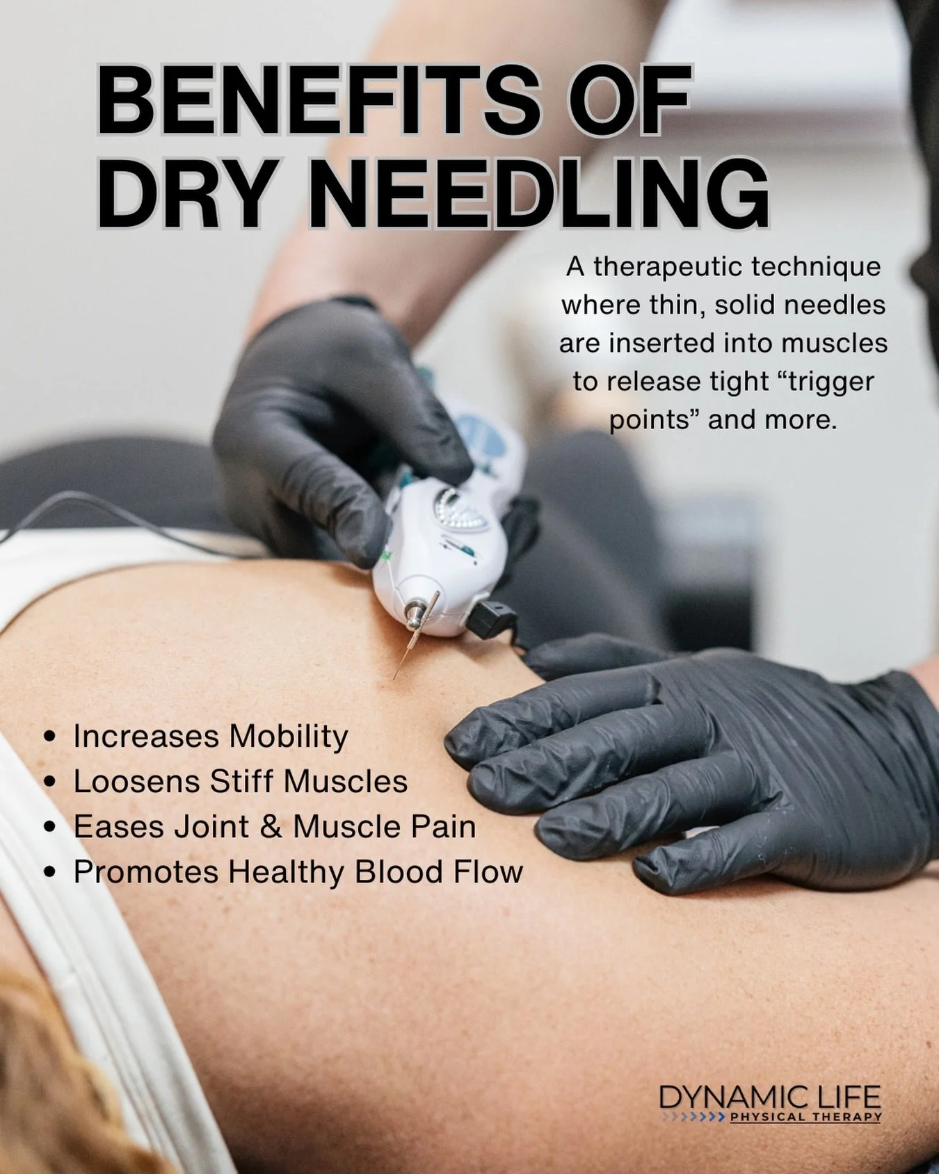 Tight muscles, stubborn pain, slow recovery? Dry needling can help reset the problem - not just mask it.

We use dry needling to help reduce muscle tension, improve mobility, decrease pain, and get you back to doing what you love faster. 

Ready to m