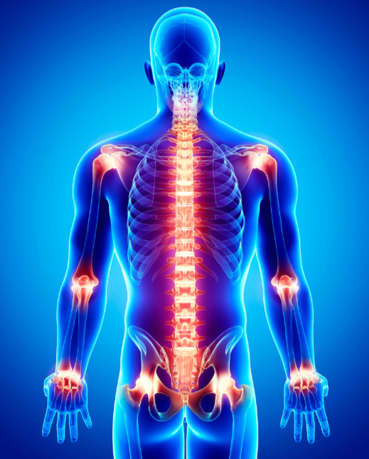 Digital illustration of a human body highlighting the spine and joints in red.