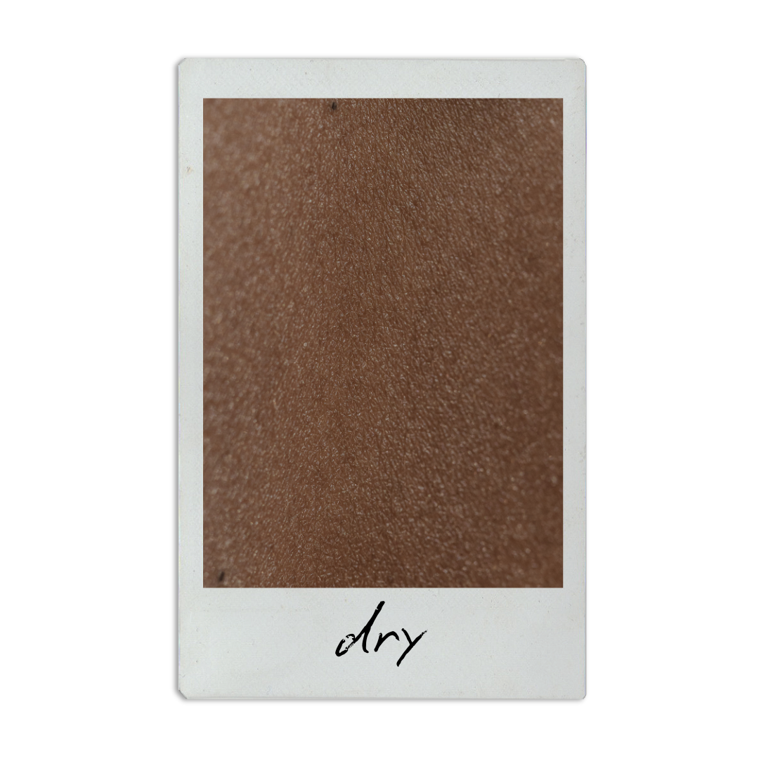 Close-up of dry brown skin with the word 'dry' written at the bottom.