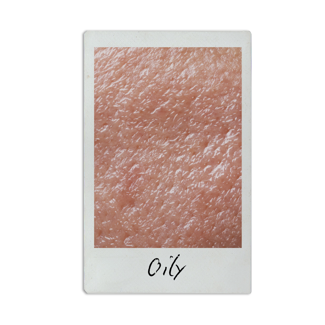 Close-up of human skin with a label 'Oily' at the bottom.