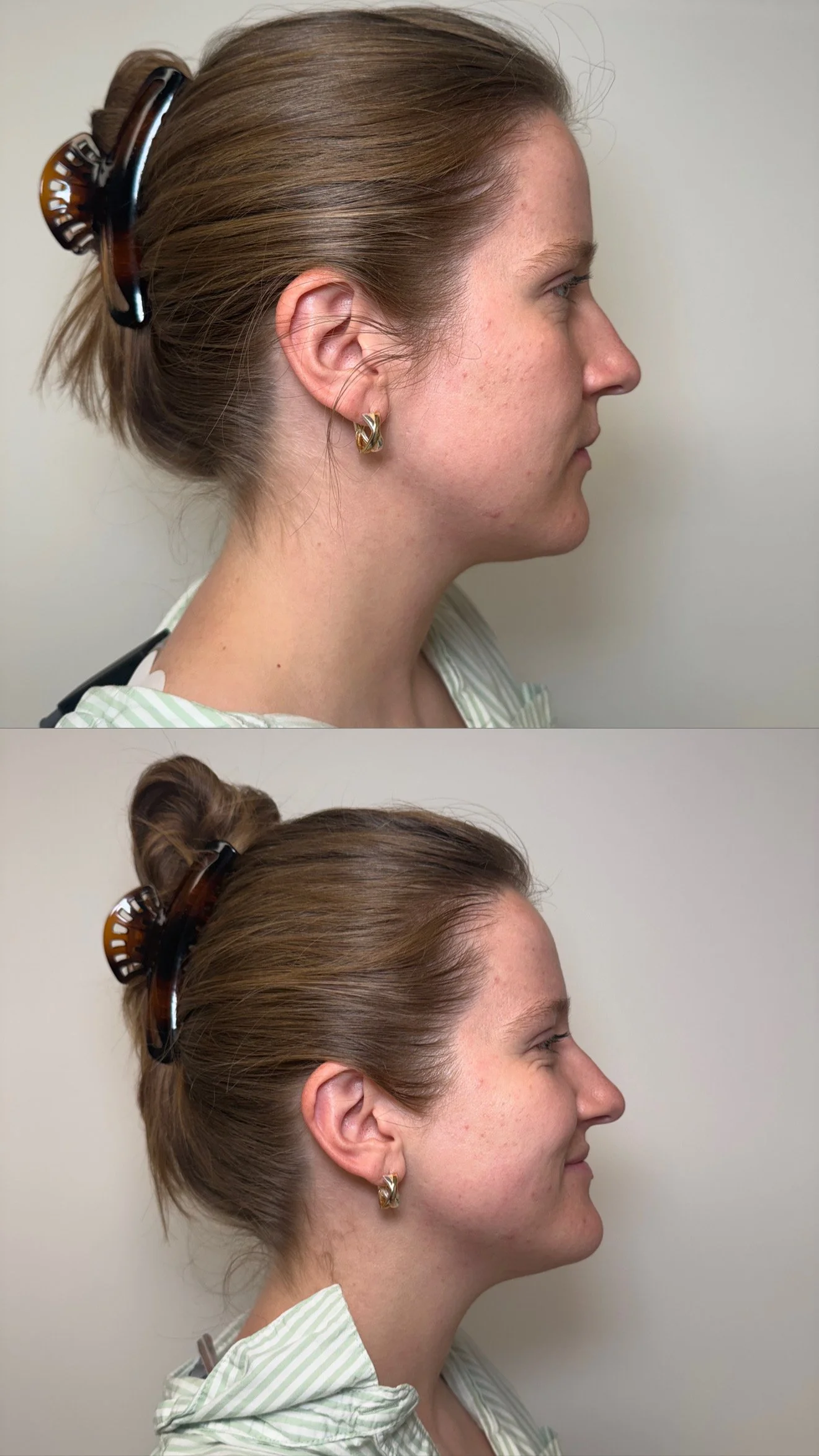 Side profile of a woman with light brown hair tied in a low bun with a tortoiseshell hair clip. She is wearing gold earrings and a light green and white striped hoodie. The image shows two views: one from the side and one from a slightly lower angle.