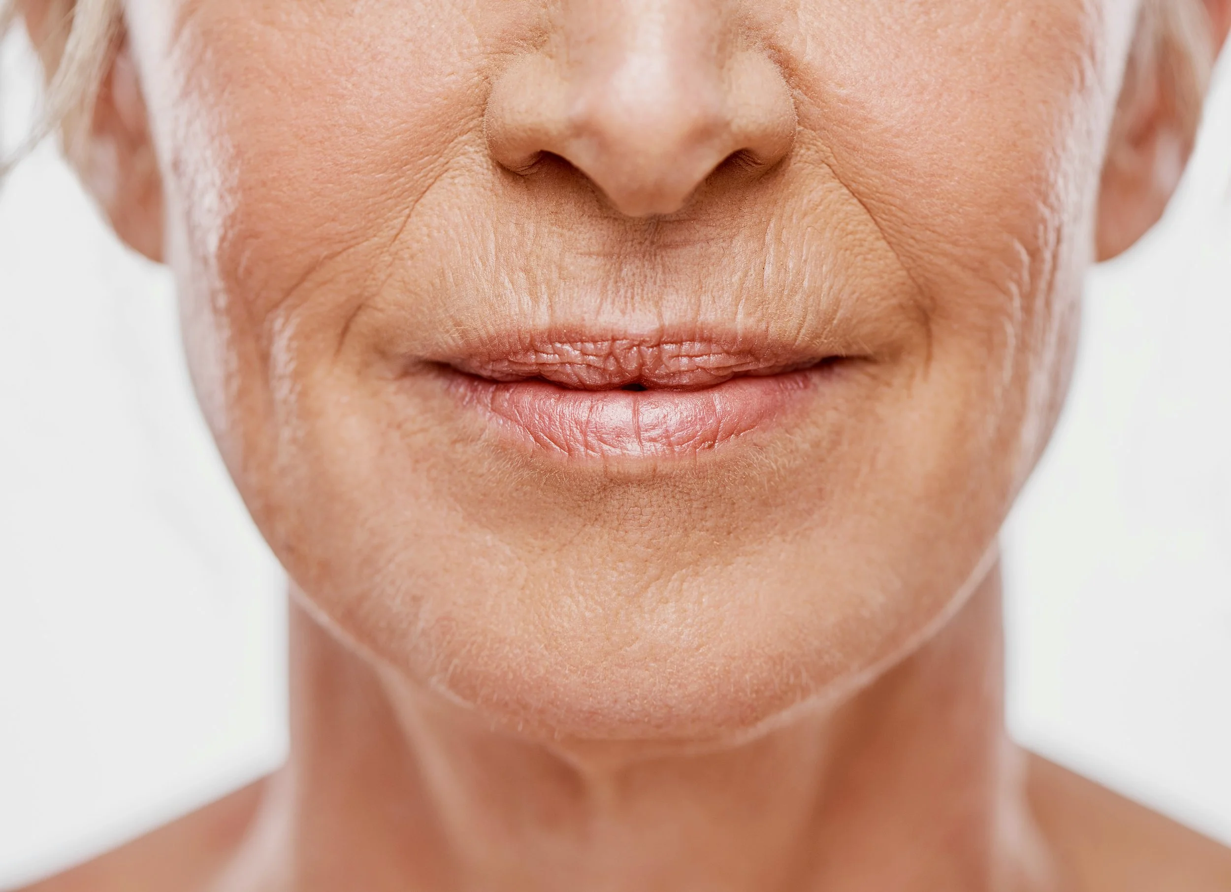 wrinkles and fine lines treatment