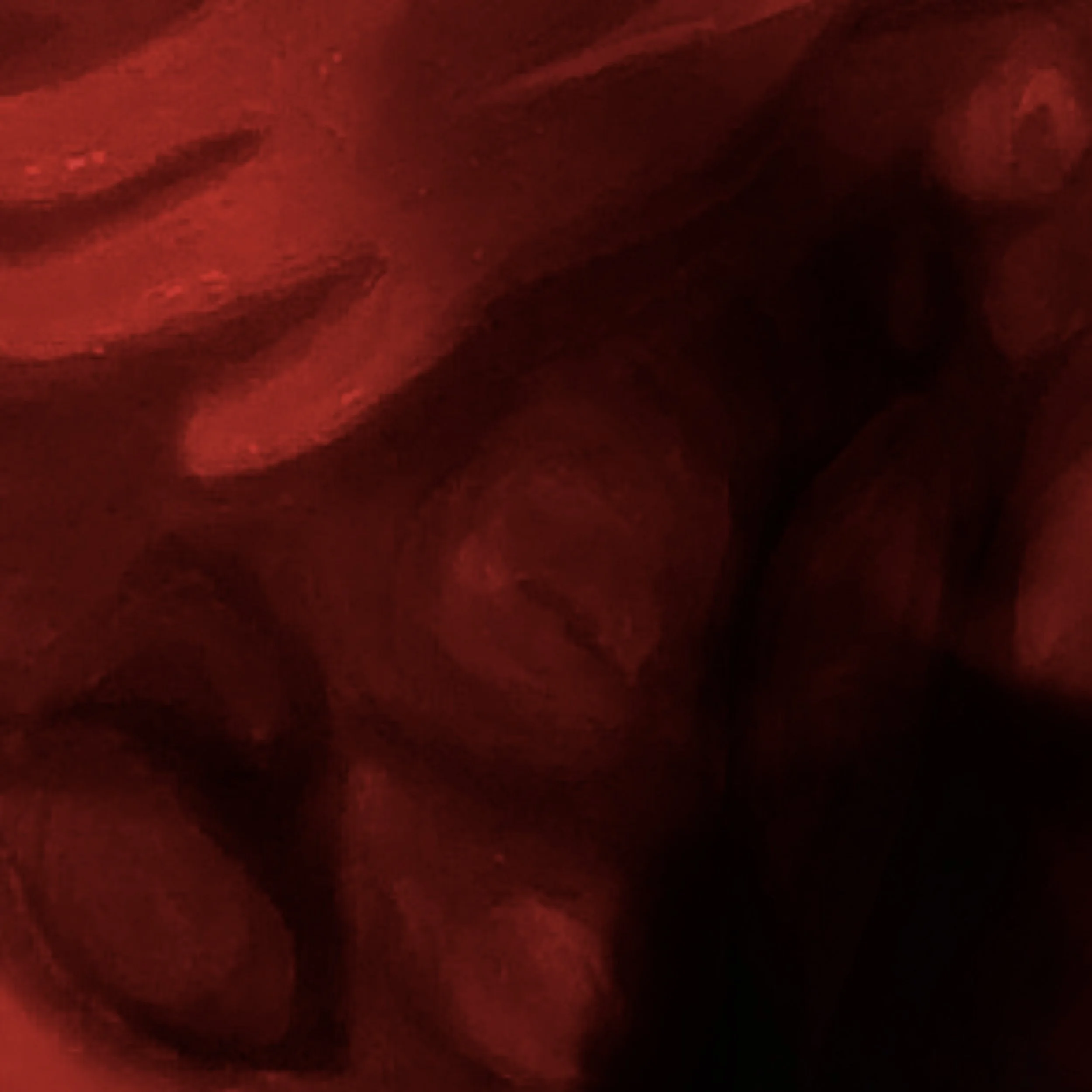 No se puede identificar claramente debido a la calidad de la imagen.