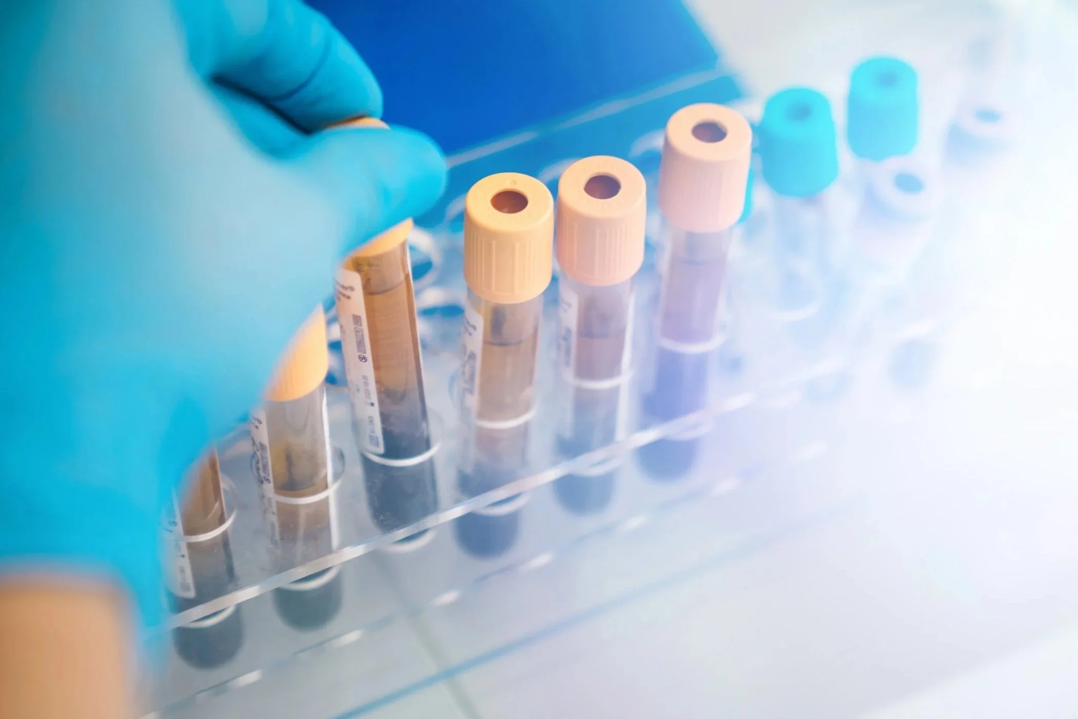 A hand wearing a blue glove holding a test tube in a lab setting, with a rack of multiple test tubes in the background.