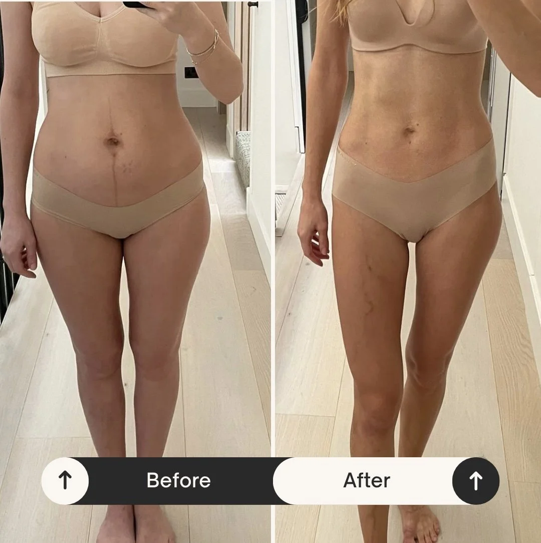 Claire before : after.jpeg