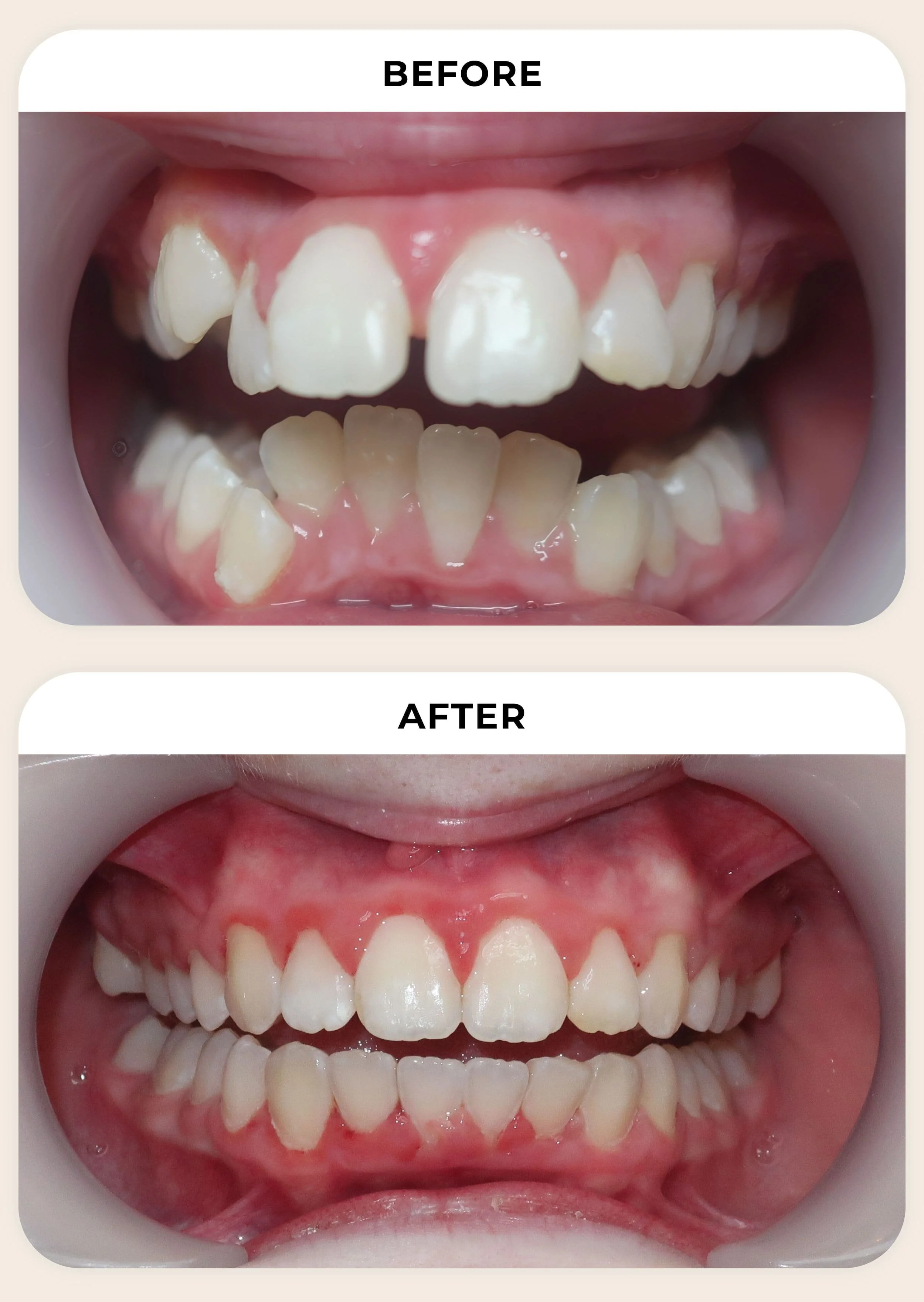 before-and-after-treatment-photo-2.jpg