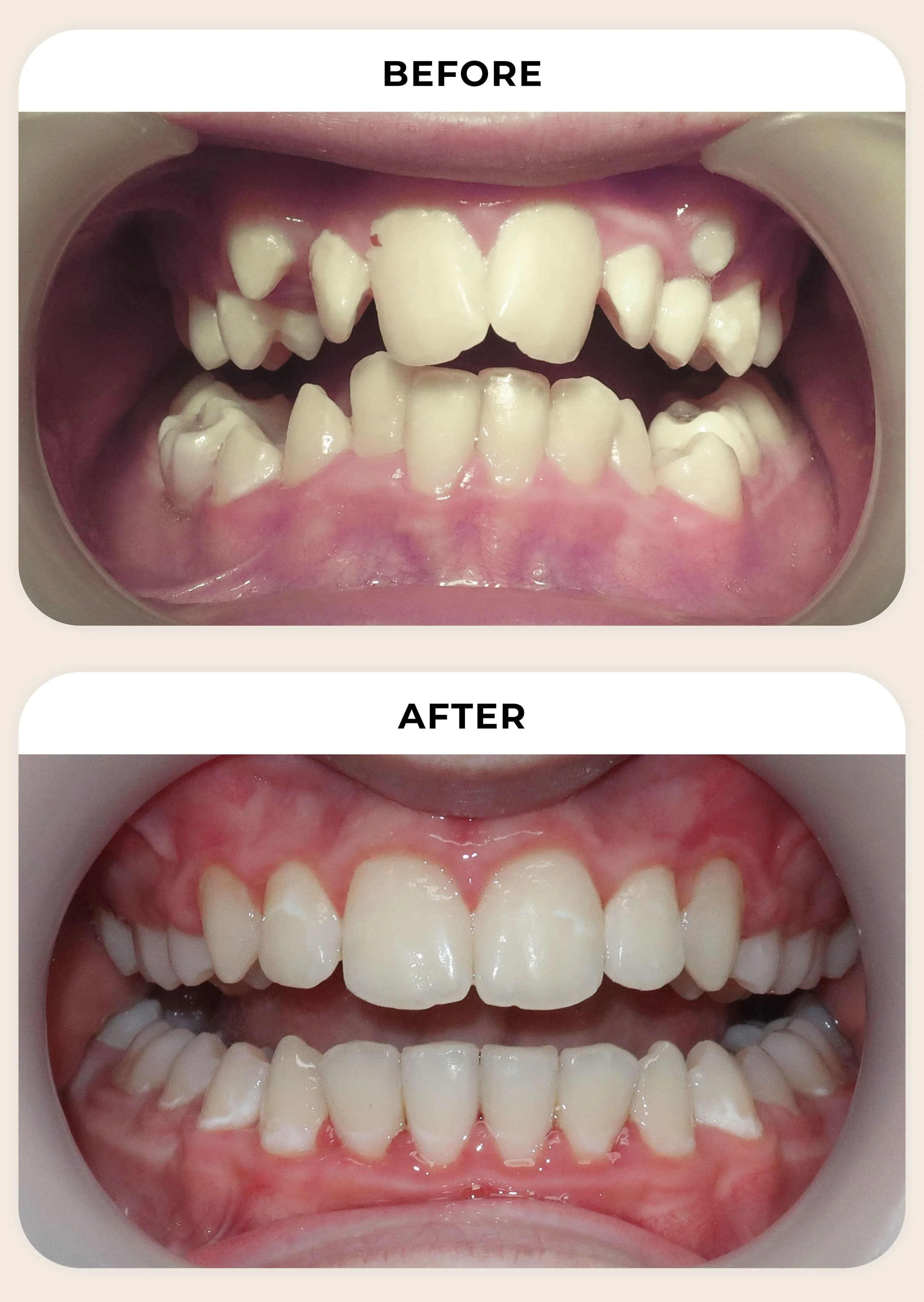 before-and-after-photo.jpg