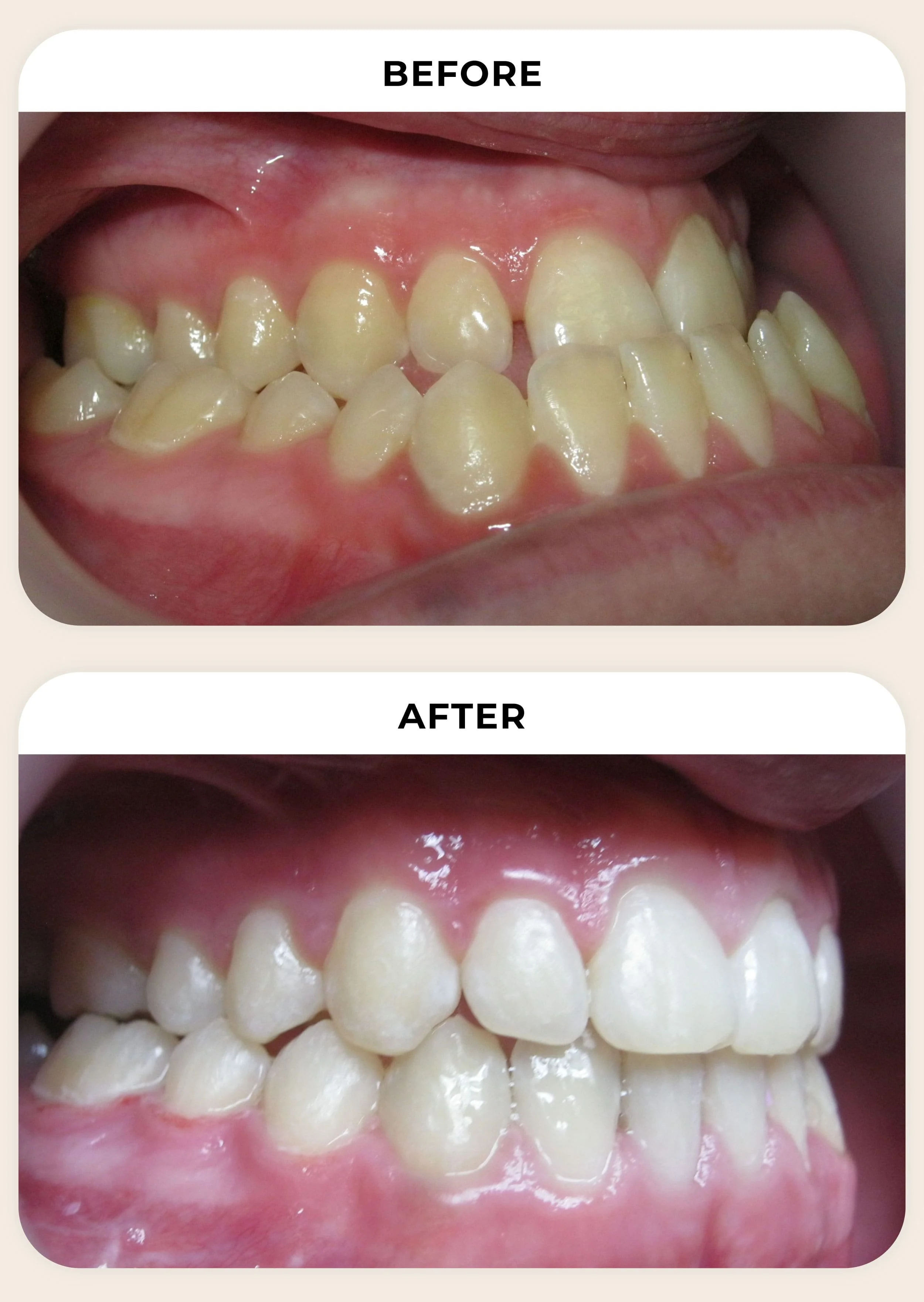 before-and-after-treatment-photo-5.jpg