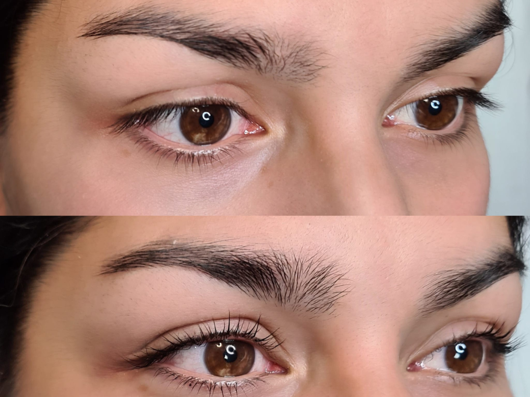 Wimpernlifting
