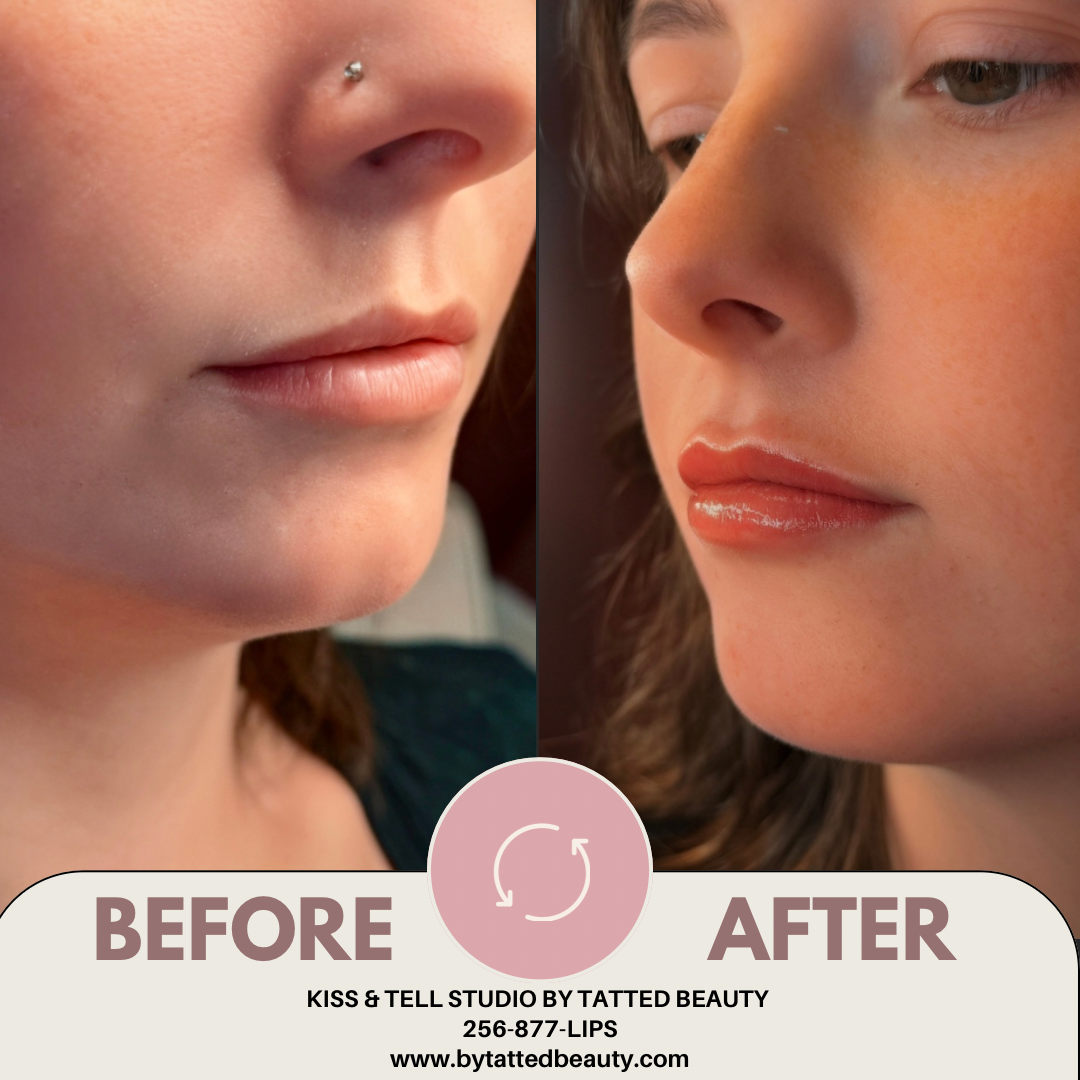 Brown Minimalist Skincare Before After Collage Instagram Post 2.PNG