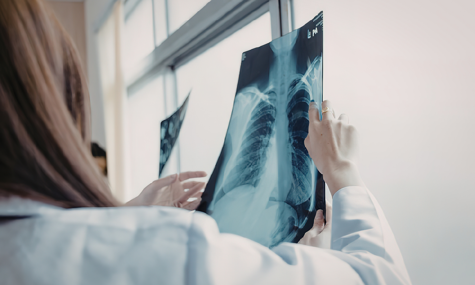 pain management doctor reviewing imaging after a car accident in Phoenix