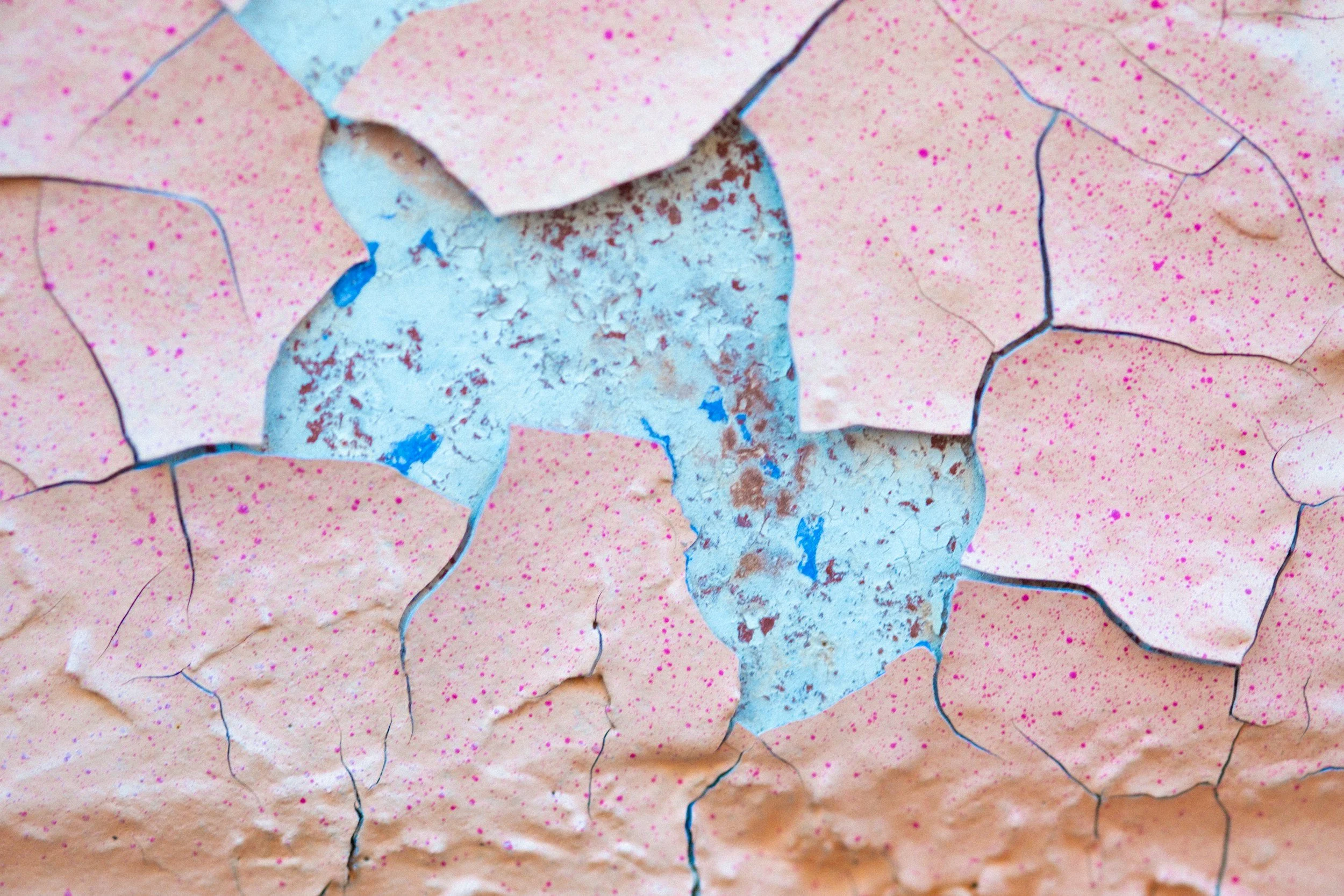 Psoriasis, Inflammation, and a Study That Landed in January 2026